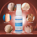 Spray para venas y varices